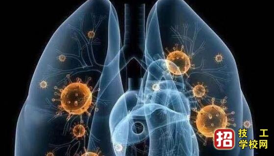 石家莊天使護士學校轉載如何區分感冒、流感 和新型冠狀病毒